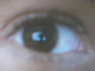 my eye